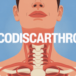 Illustration uncodiscarthrose cervicale stylisée